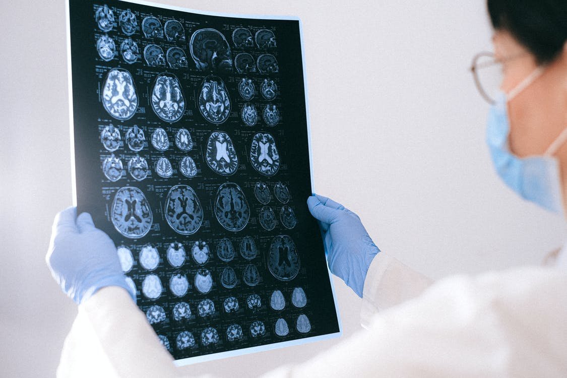 brain imaging
